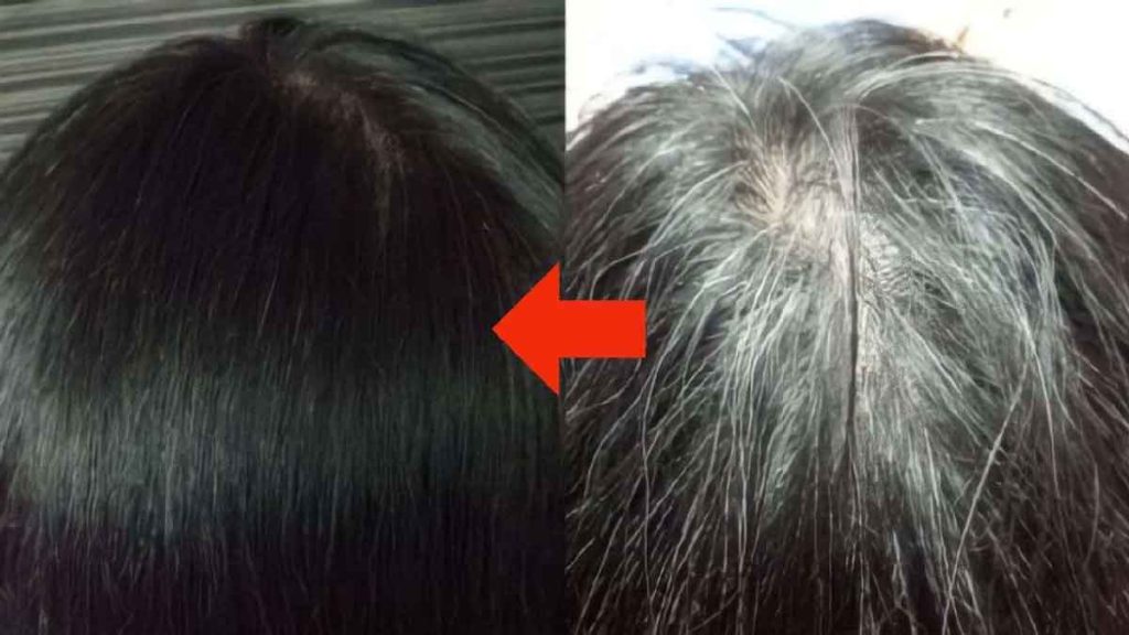 Adiós a las canas: descubre el secreto para ocultarlas sin tintes ni decolorantes